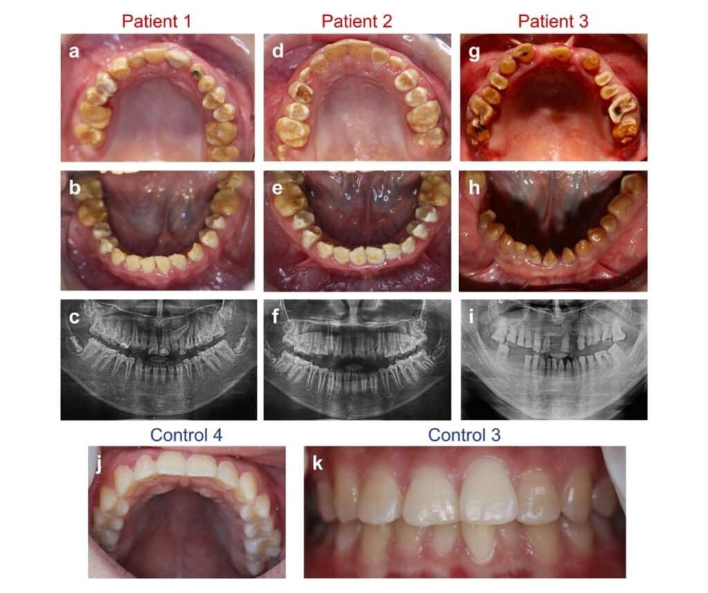 Template ภาพประกอบ Research Highlights 17 Faculty of Dentistry, Chulalongkorn University