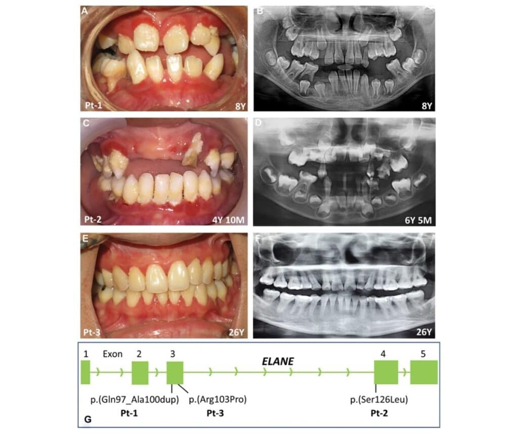 Template ภาพประกอบ Research Highlights 18 Faculty of Dentistry, Chulalongkorn University