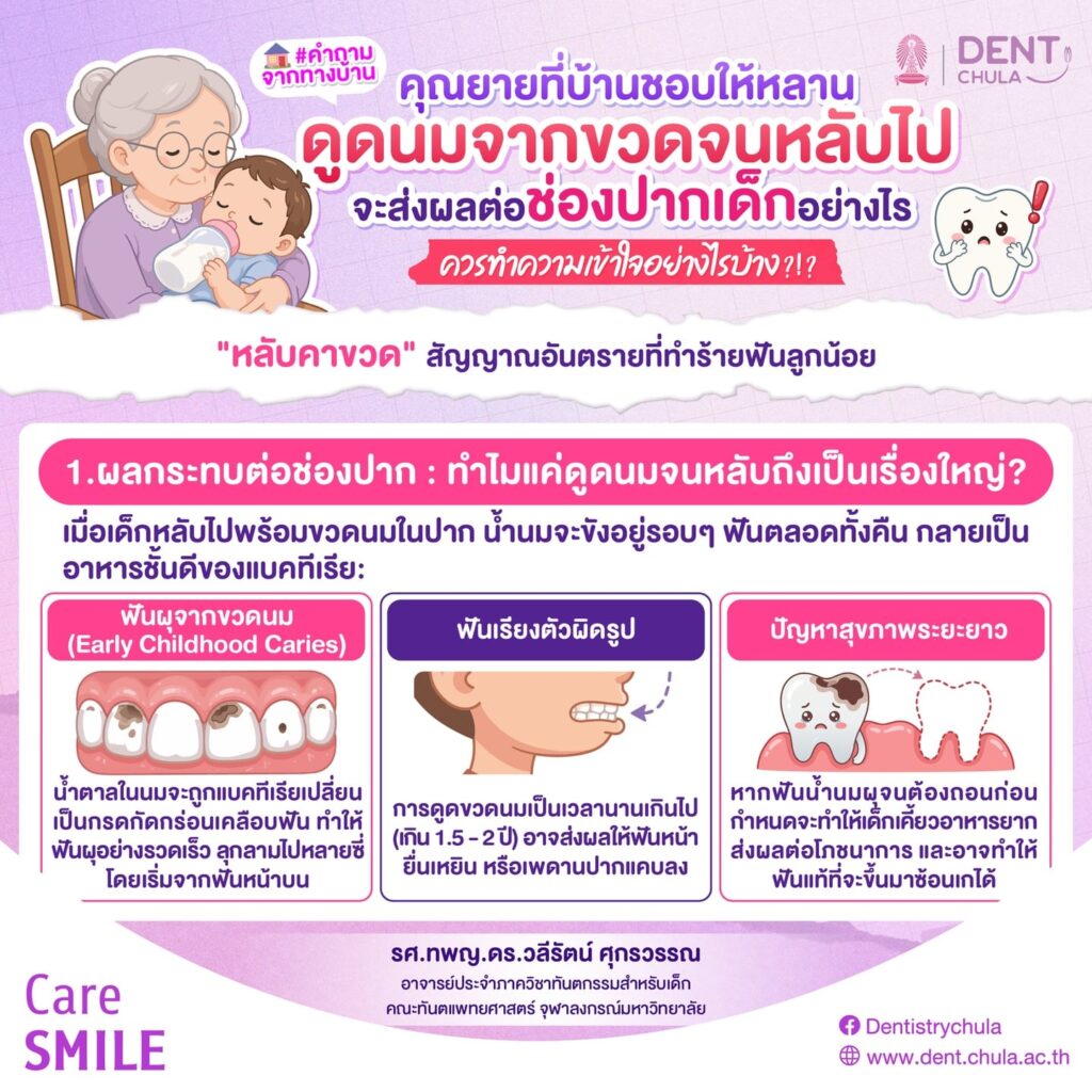 ขวดนมตอนนอนทำให้ฟันผุจริงไหม 1 0 คณะทันตแพทยศาสตร์ จุฬาลงกรณ์มหาวิทยาลัย