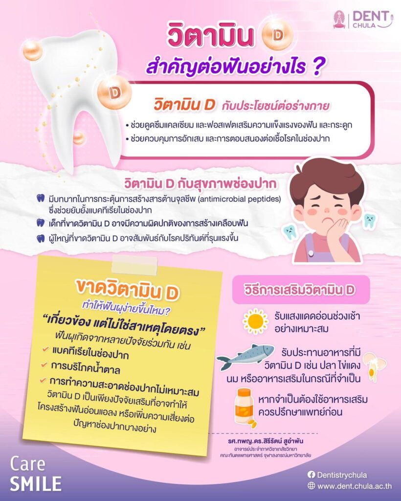 ขาดวิตามิน D ทำให้ฟันผุจริงมั้ย คณะทันตแพทยศาสตร์ จุฬาลงกรณ์มหาวิทยาลัย