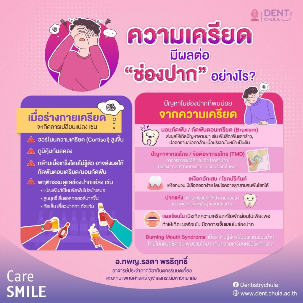 ความเครียด vs โรคทางพันธุกรรม 01 คณะทันตแพทยศาสตร์ จุฬาลงกรณ์มหาวิทยาลัย