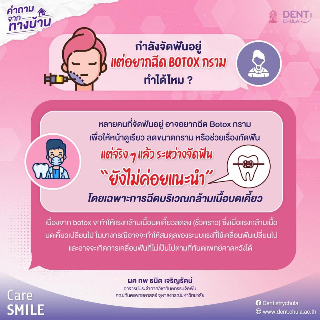 จัดฟันอยู่ ฉีดโบทอกซ์กรามได้มั้ย คณะทันตแพทยศาสตร์ จุฬาลงกรณ์มหาวิทยาลัย