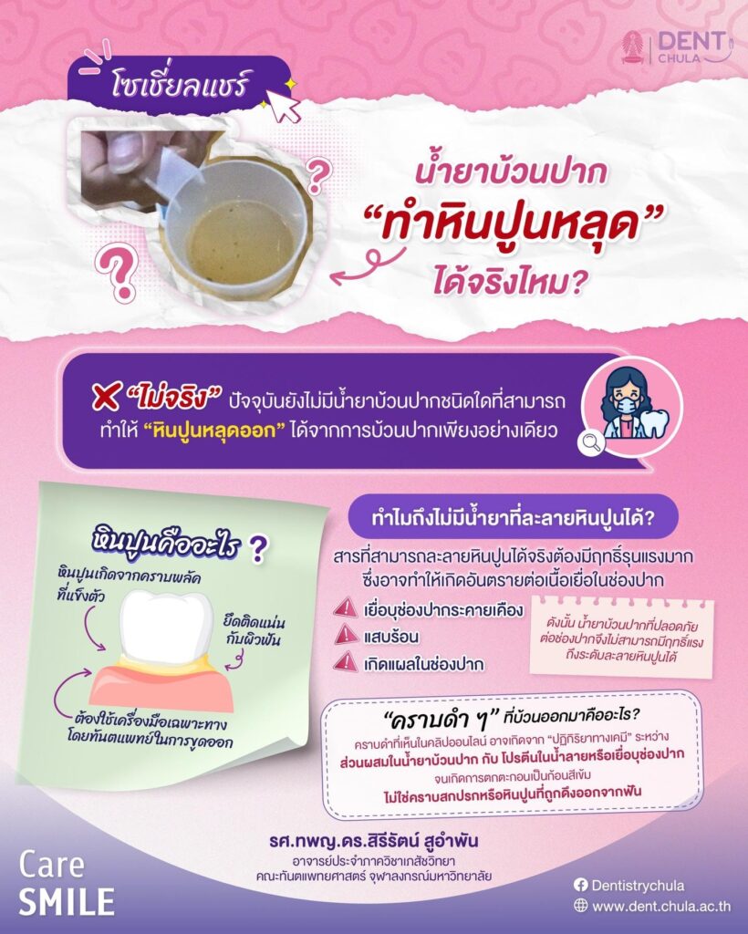 น้ำยาบ้วนปากในโลกออนไลน์ คณะทันตแพทยศาสตร์ จุฬาลงกรณ์มหาวิทยาลัย