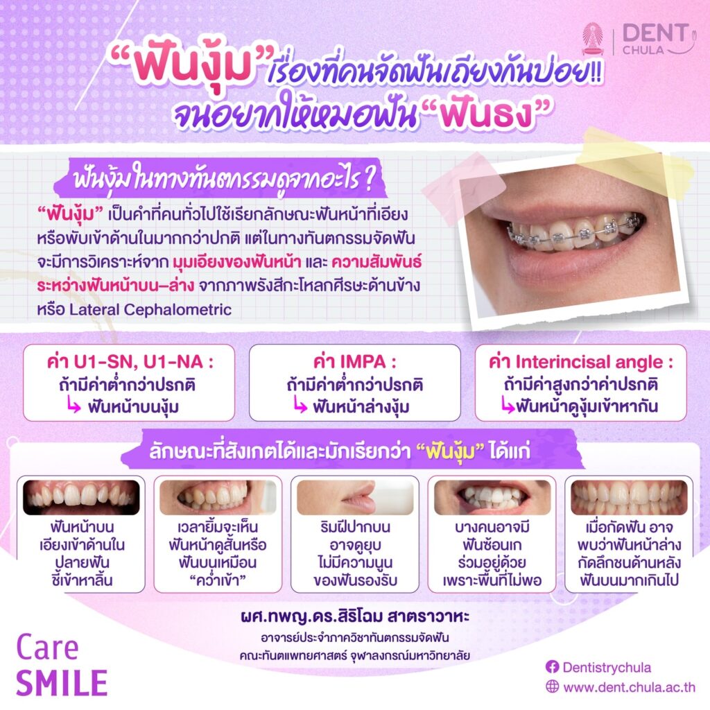 ฟันงุ้ม 1 0 คณะทันตแพทยศาสตร์ จุฬาลงกรณ์มหาวิทยาลัย