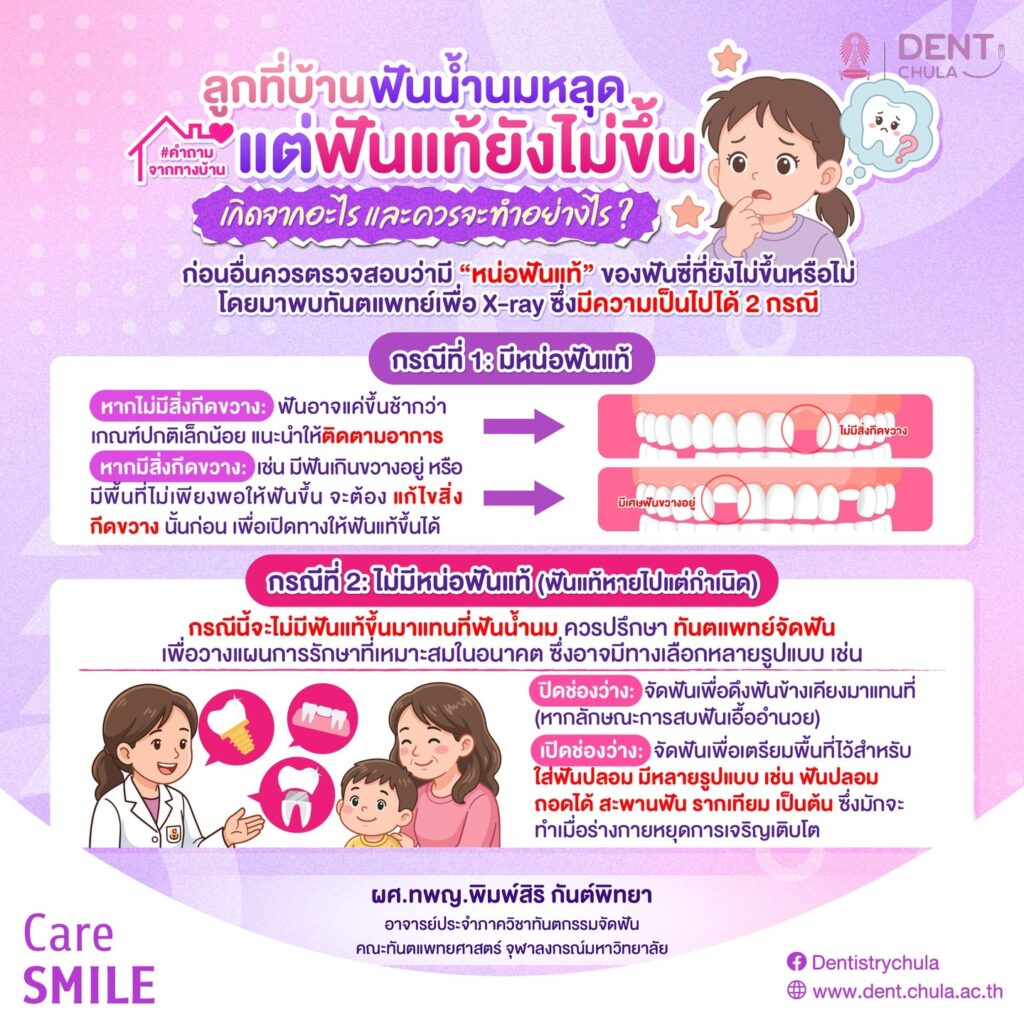 ฟันน้ำนมหลุด แต่ฟันแท้ไม่ขึ้น คณะทันตแพทยศาสตร์ จุฬาลงกรณ์มหาวิทยาลัย
