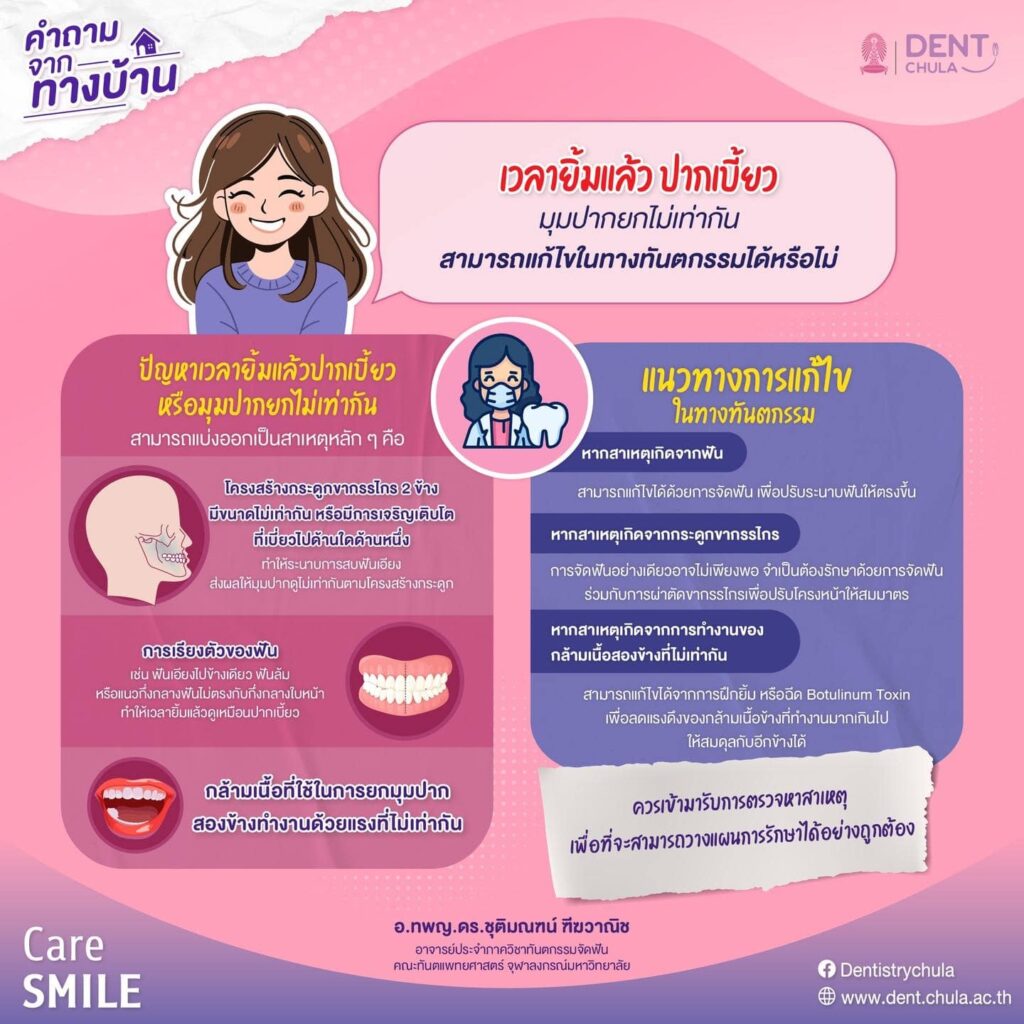 ยิ้มแล้วปากเบี้ยว ทันตกรรมช่วยได้ไหม คณะทันตแพทยศาสตร์ จุฬาลงกรณ์มหาวิทยาลัย