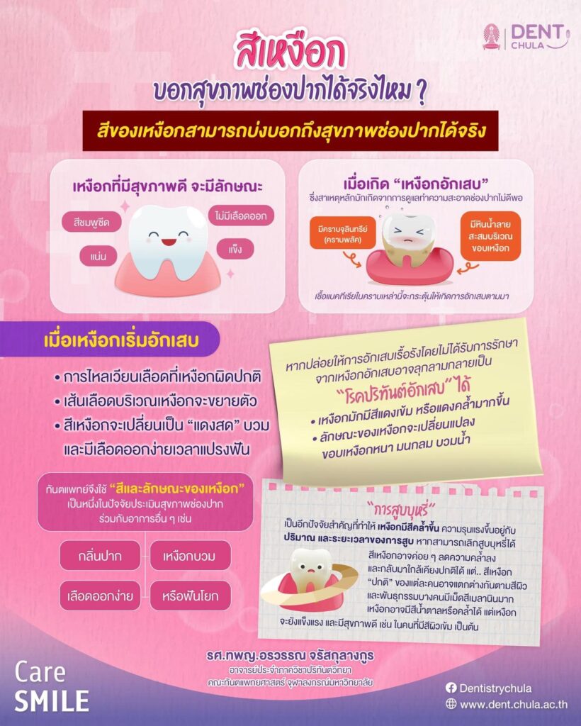 สีเหงือกบอกสุขภาพช่องปาก คณะทันตแพทยศาสตร์ จุฬาลงกรณ์มหาวิทยาลัย