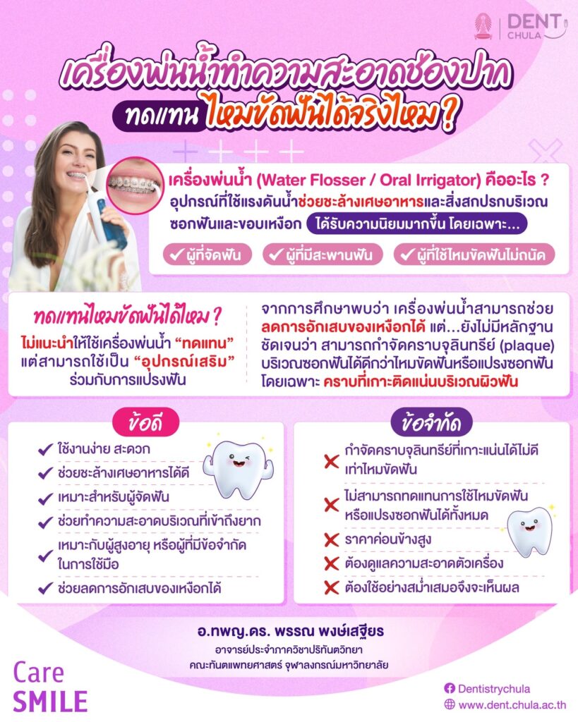 เครื่องพ่นน้ำ แทนไหมขัดฟันได้ไหม คณะทันตแพทยศาสตร์ จุฬาลงกรณ์มหาวิทยาลัย