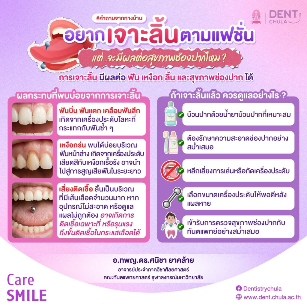 เจาะลิ้นมีผลต่อฟันหรือไม่ คณะทันตแพทยศาสตร์ จุฬาลงกรณ์มหาวิทยาลัย