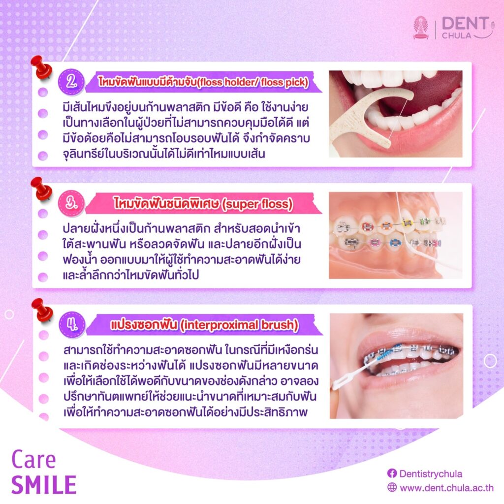 ไหมขัดฟัน 2 0 คณะทันตแพทยศาสตร์ จุฬาลงกรณ์มหาวิทยาลัย