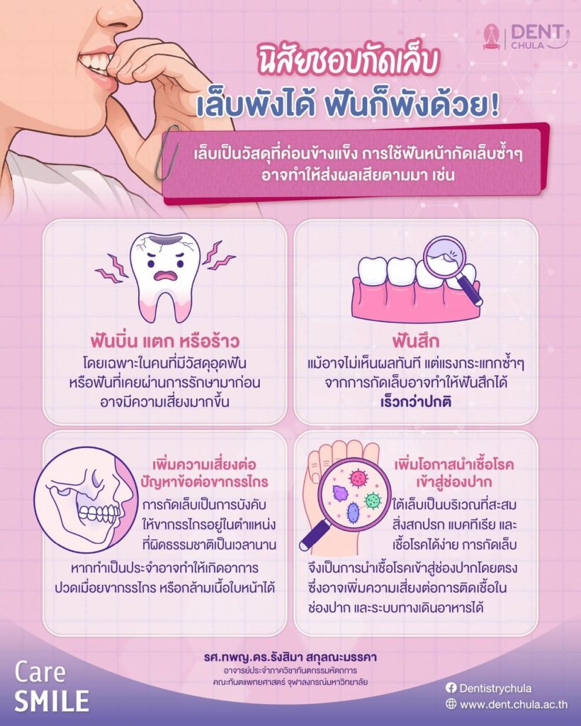 การกัดเล็บมีผลต่อฟันหรือไม่ คณะทันตแพทยศาสตร์ จุฬาลงกรณ์มหาวิทยาลัย