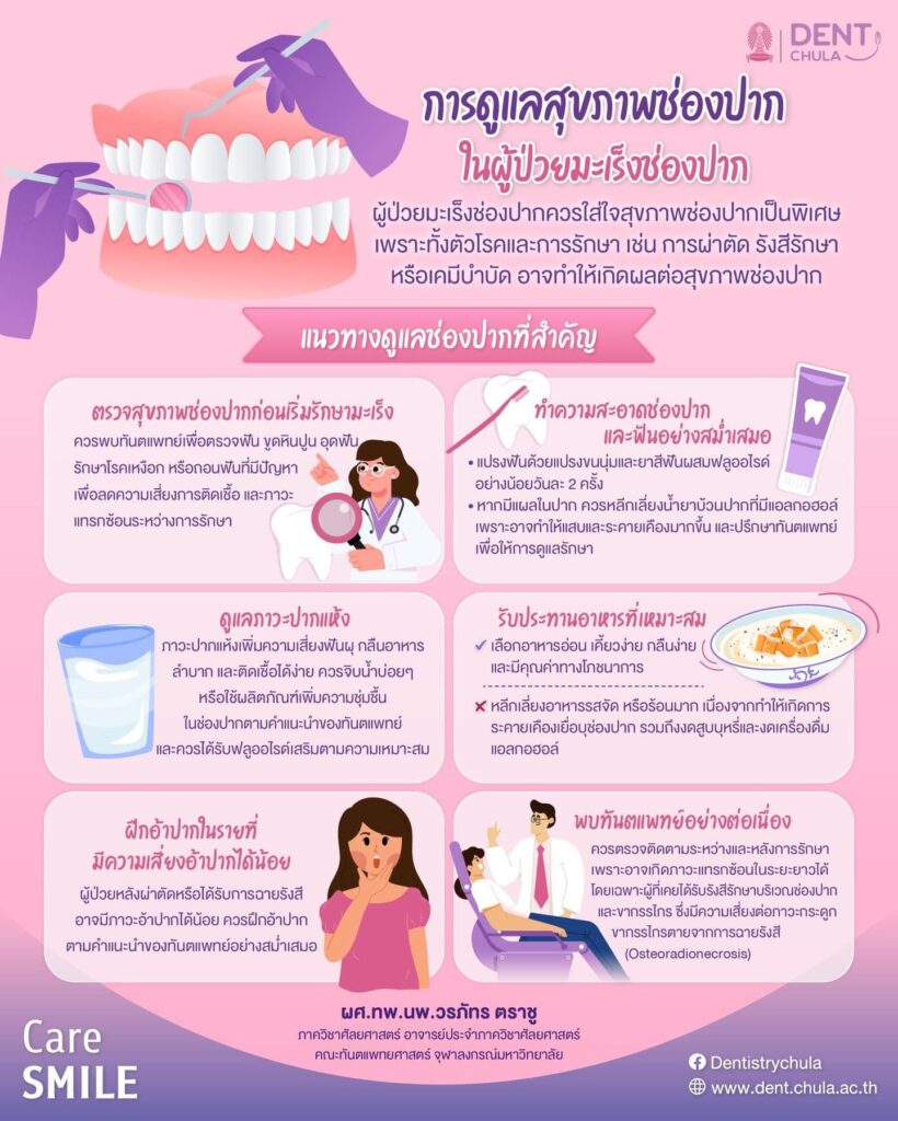 การดูแลสุขภาพช่องปากในผู้ป่วยมะเร็งช่องปาก คณะทันตแพทยศาสตร์ จุฬาลงกรณ์มหาวิทยาลัย