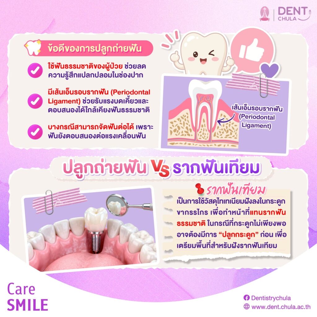การปลูกถ่ายฟัน 2 0 คณะทันตแพทยศาสตร์ จุฬาลงกรณ์มหาวิทยาลัย