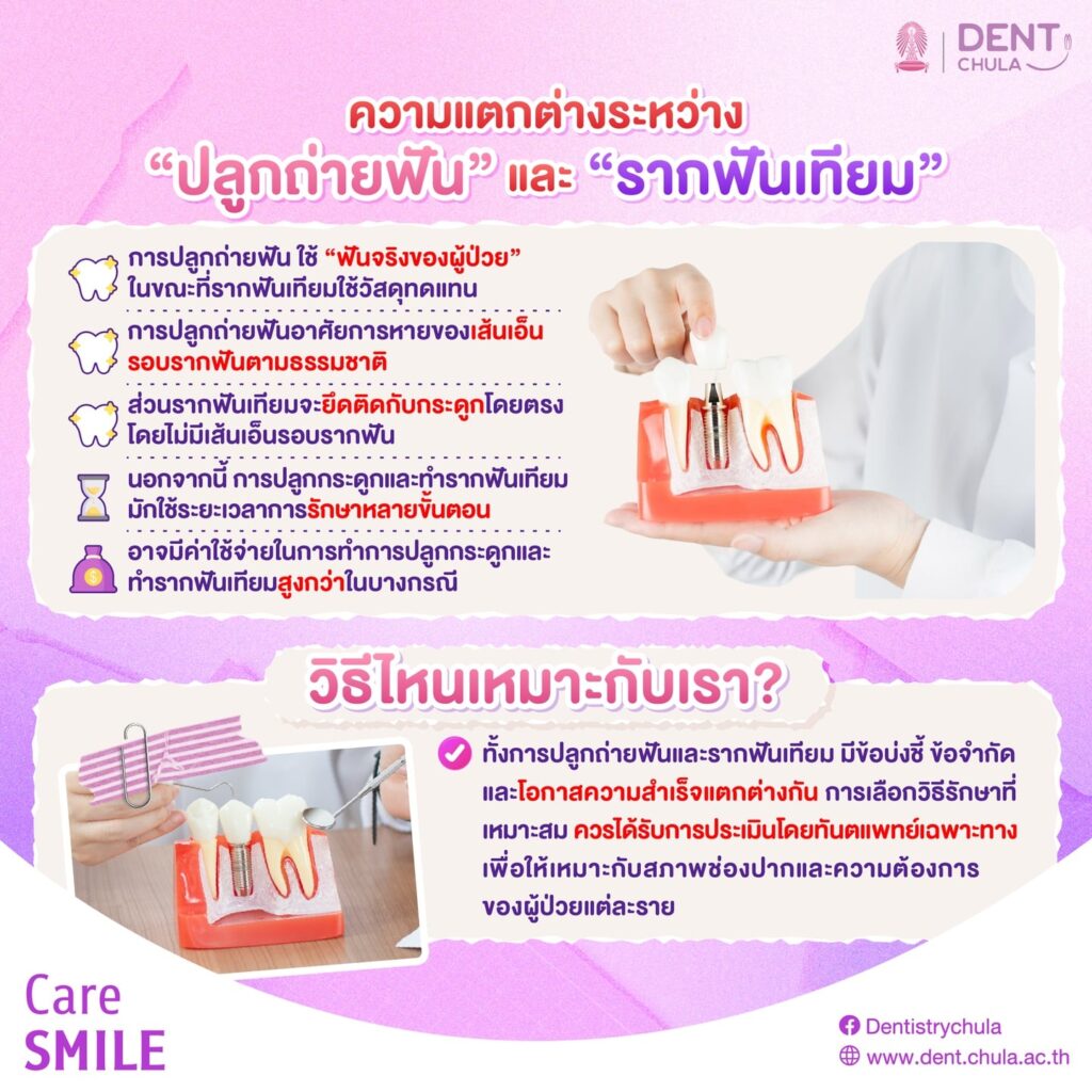การปลูกถ่ายฟัน 3 0 คณะทันตแพทยศาสตร์ จุฬาลงกรณ์มหาวิทยาลัย