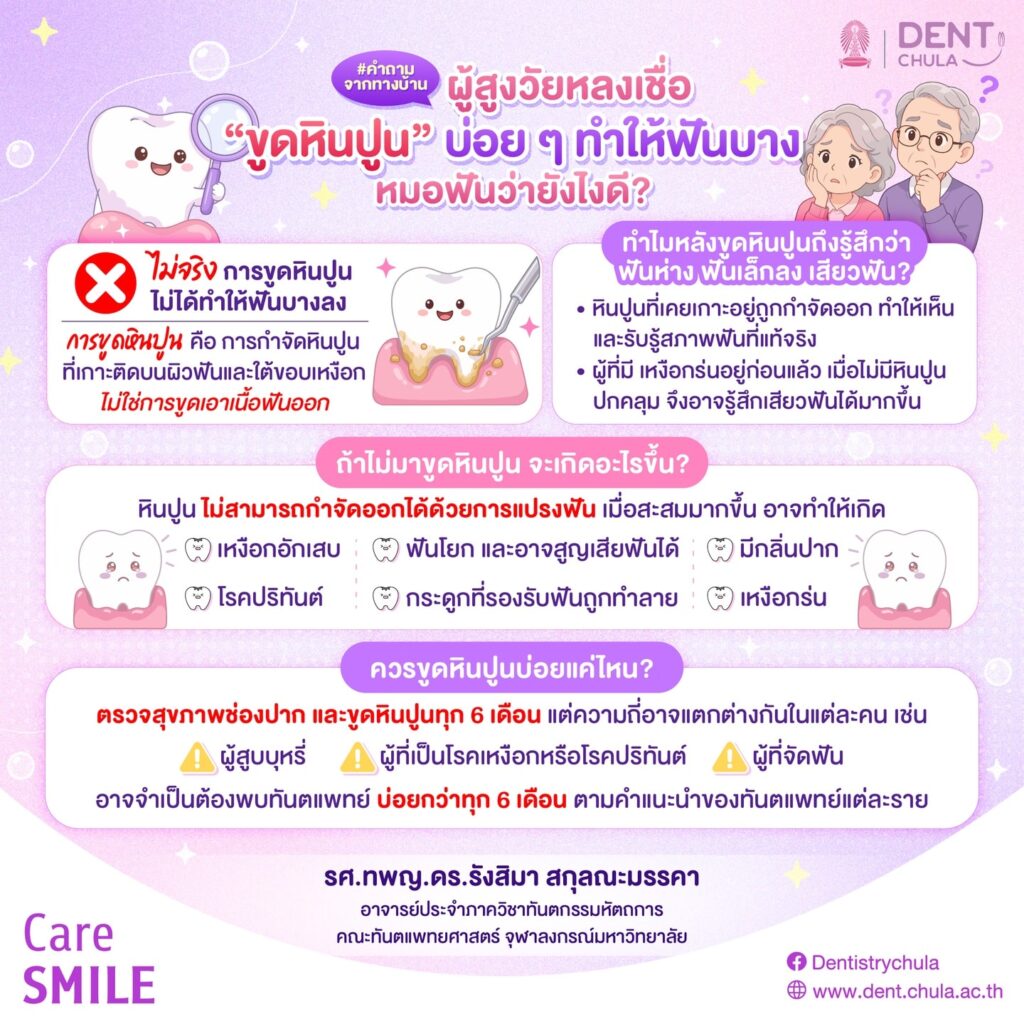 ขูดหินปูนบ่อย ฟันจะบางจริงไหม คณะทันตแพทยศาสตร์ จุฬาลงกรณ์มหาวิทยาลัย