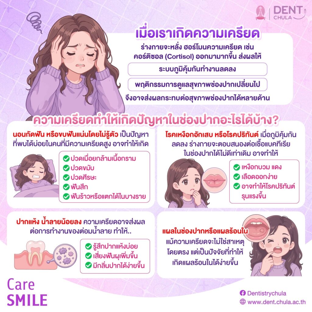 ความเครียด vs สุขภาพช่องปาก 2 0 คณะทันตแพทยศาสตร์ จุฬาลงกรณ์มหาวิทยาลัย
