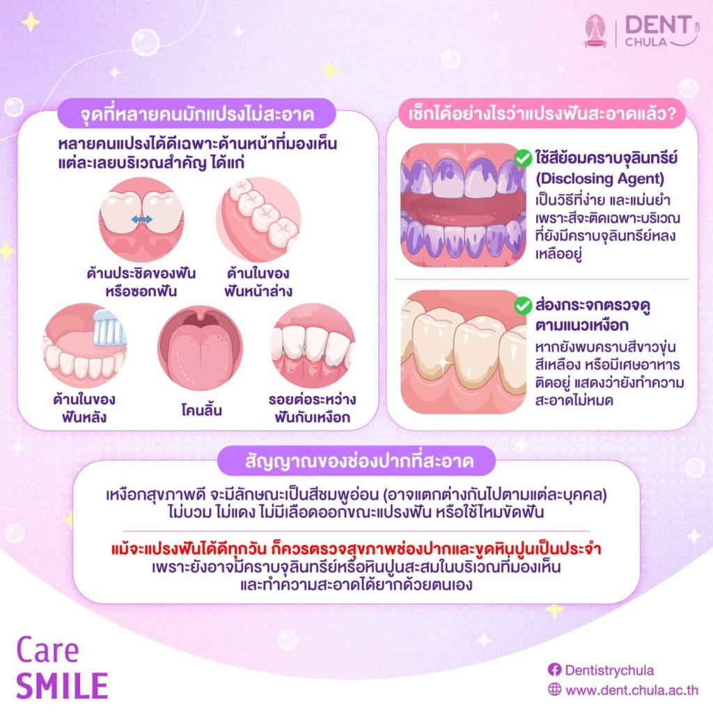 จุดซ่อนเร้นเชื้อโรค 2 0 คณะทันตแพทยศาสตร์ จุฬาลงกรณ์มหาวิทยาลัย