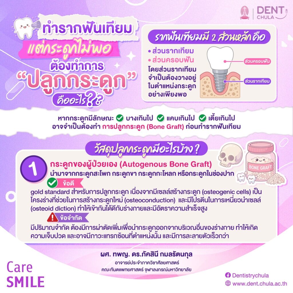 ทำรากเทียมแต่กระดูกไม่พอ 1 0 คณะทันตแพทยศาสตร์ จุฬาลงกรณ์มหาวิทยาลัย