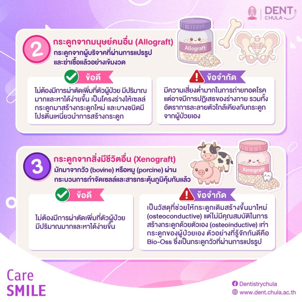 ทำรากเทียมแต่กระดูกไม่พอ 2 0 คณะทันตแพทยศาสตร์ จุฬาลงกรณ์มหาวิทยาลัย