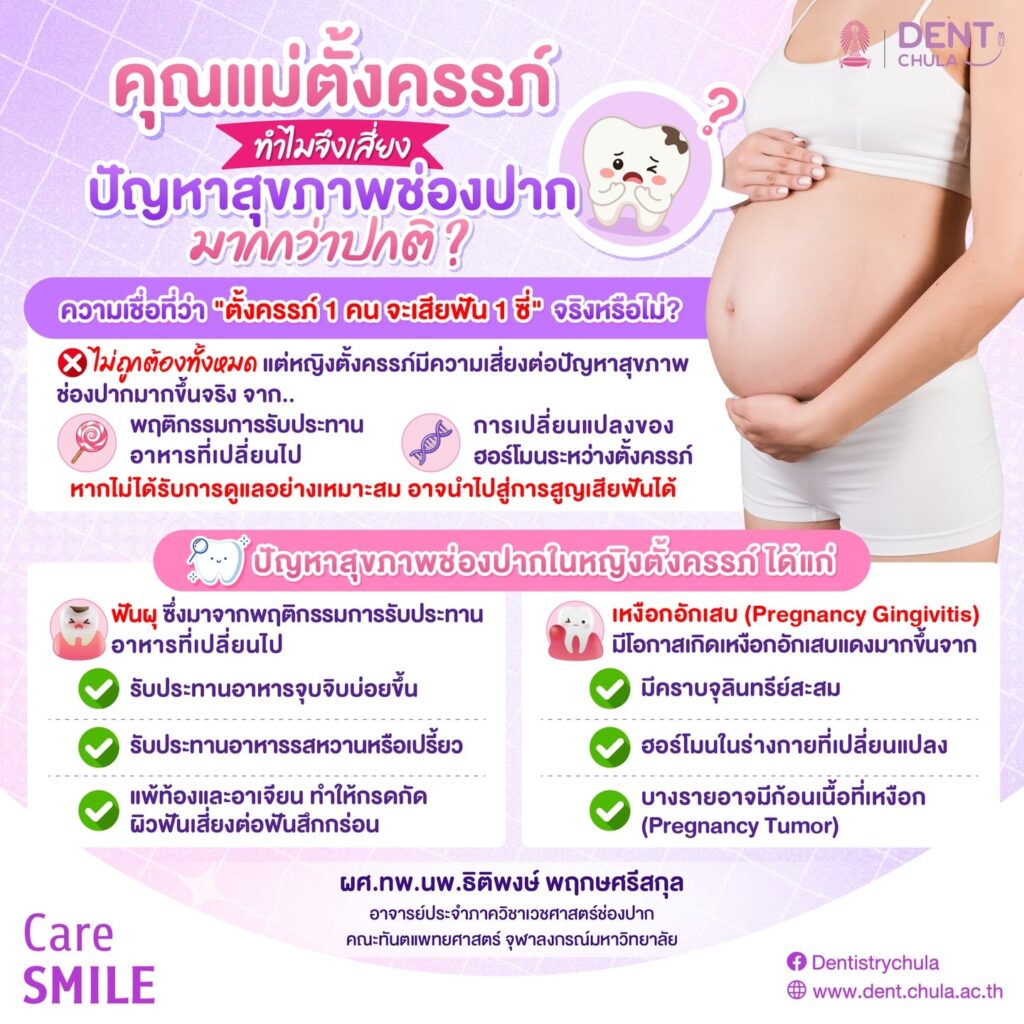 ปัญหาฟันกับการตั้งครรภ์ 1 0 คณะทันตแพทยศาสตร์ จุฬาลงกรณ์มหาวิทยาลัย