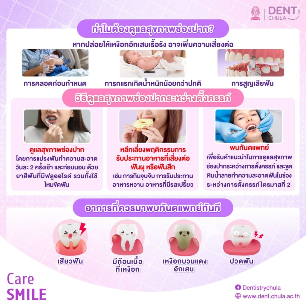 ปัญหาฟันกับการตั้งครรภ์ 2 0 คณะทันตแพทยศาสตร์ จุฬาลงกรณ์มหาวิทยาลัย