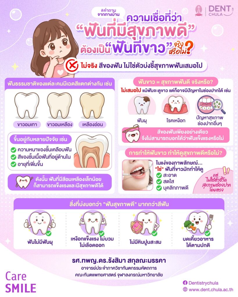 ฟันขาวคือฟันสุขภาพดีเสมอหรือไม่ คณะทันตแพทยศาสตร์ จุฬาลงกรณ์มหาวิทยาลัย