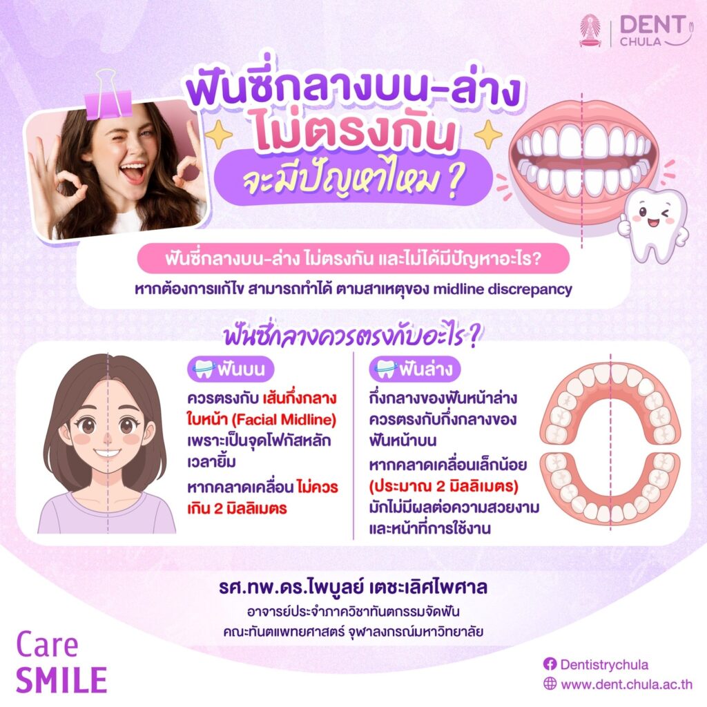ฟันซีกลางไม่ตรงกัน 1 1 คณะทันตแพทยศาสตร์ จุฬาลงกรณ์มหาวิทยาลัย
