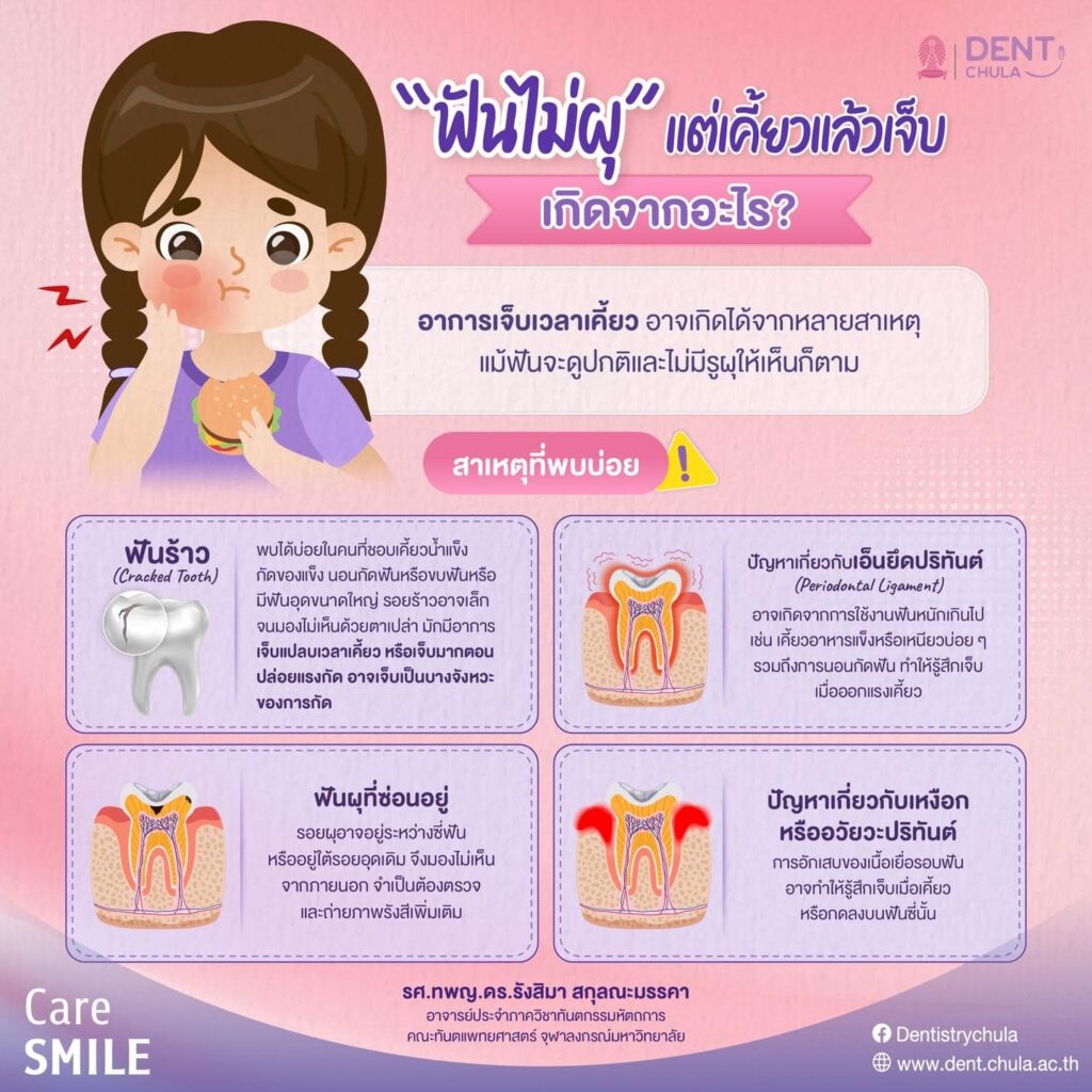 ฟันไม่ผุแต่เคี้ยวแล้วเจ็บ 01 คณะทันตแพทยศาสตร์ จุฬาลงกรณ์มหาวิทยาลัย