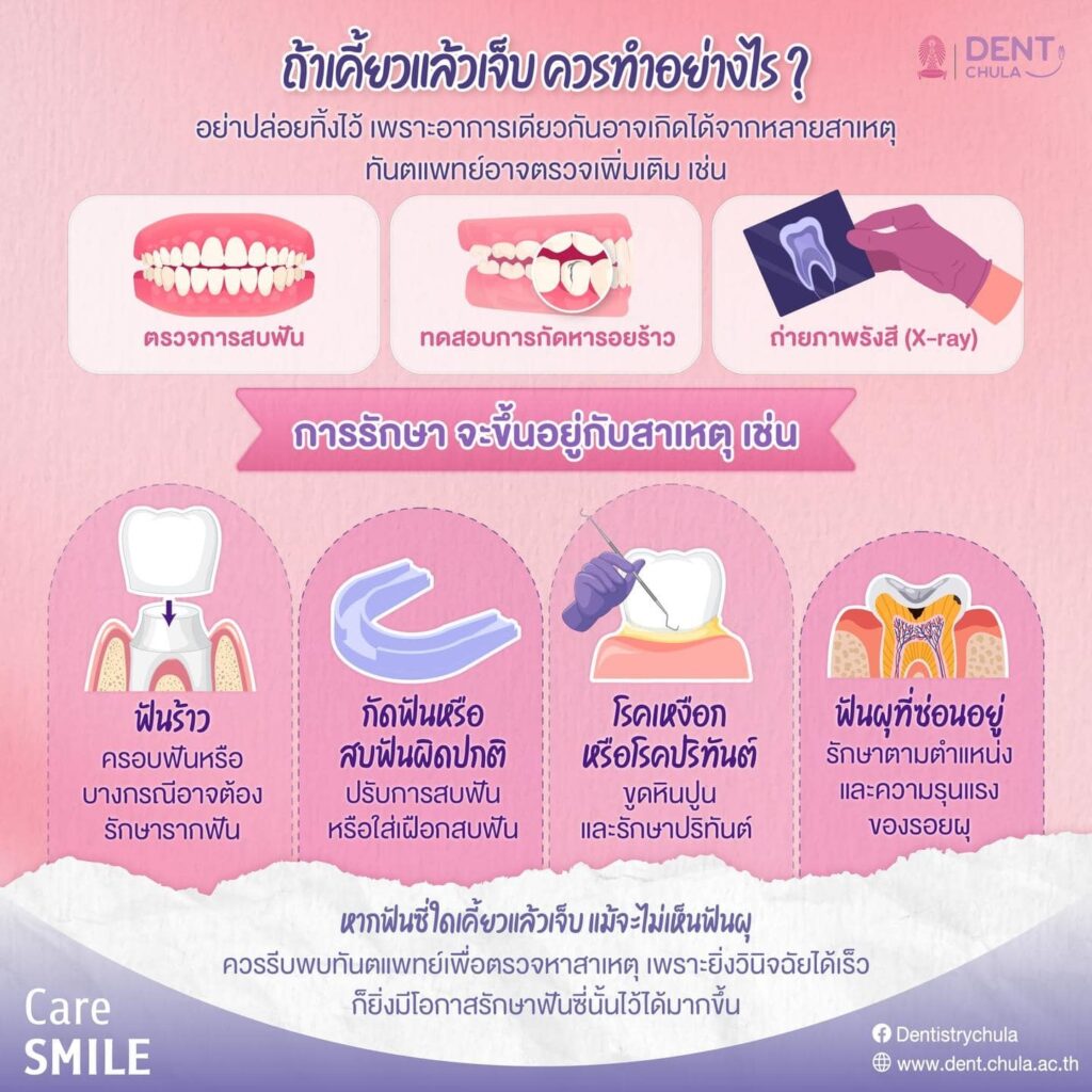 ฟันไม่ผุแต่เคี้ยวแล้วเจ็บ 02 คณะทันตแพทยศาสตร์ จุฬาลงกรณ์มหาวิทยาลัย