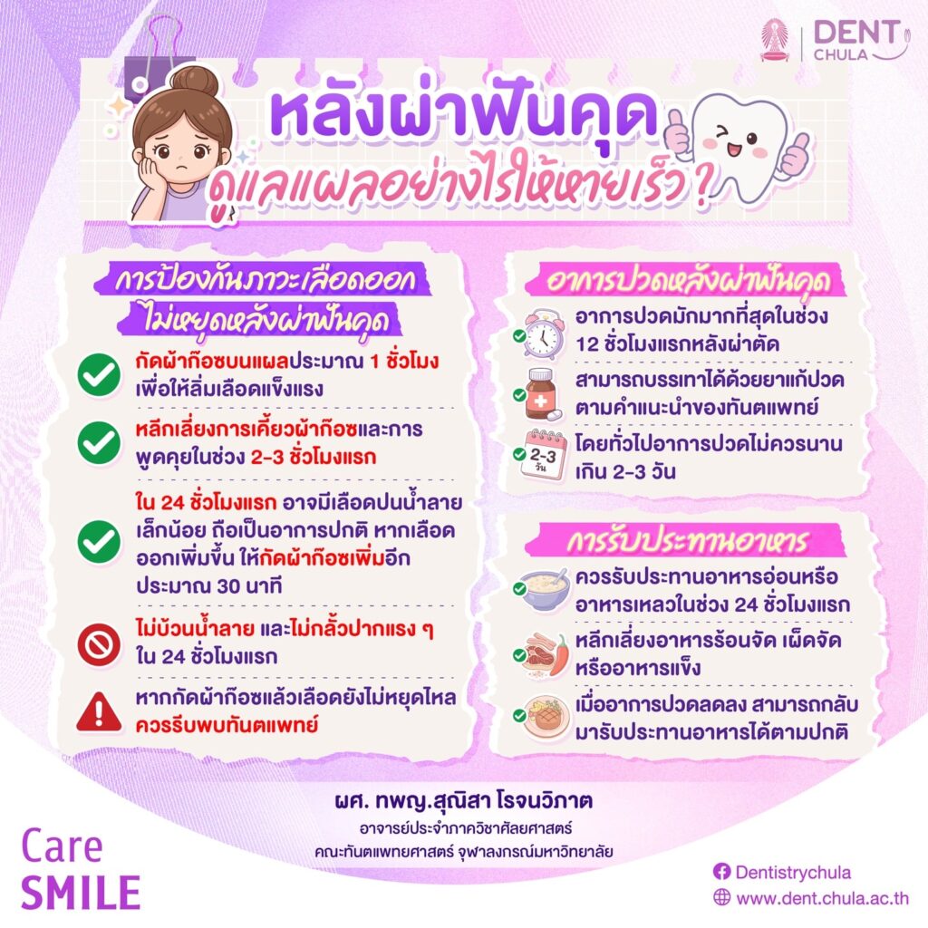 วิธีการดูแลแผลหลังผ่าฟันคุด 1 0 คณะทันตแพทยศาสตร์ จุฬาลงกรณ์มหาวิทยาลัย