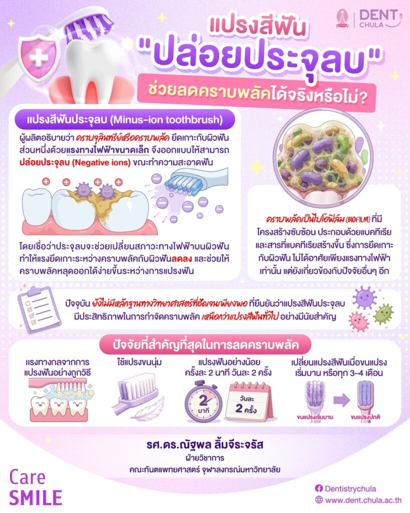 แปรงสีฟันประจุลบ คืออะไร คณะทันตแพทยศาสตร์ จุฬาลงกรณ์มหาวิทยาลัย