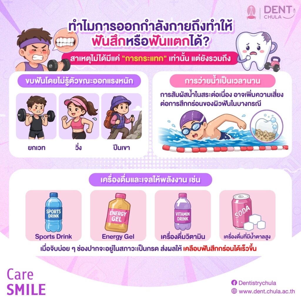 แผ่นกันฟันสึกสำหรับนักกีฬา 2 0 คณะทันตแพทยศาสตร์ จุฬาลงกรณ์มหาวิทยาลัย