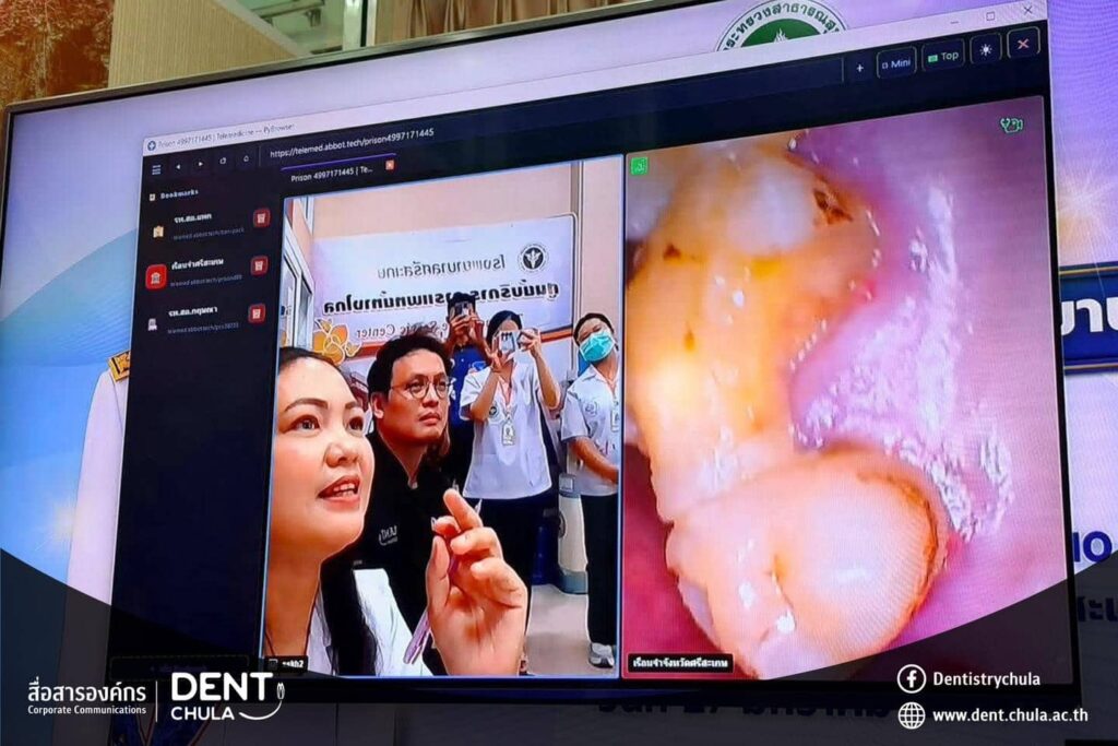 Teledentistry 06 คณะทันตแพทยศาสตร์ จุฬาลงกรณ์มหาวิทยาลัย