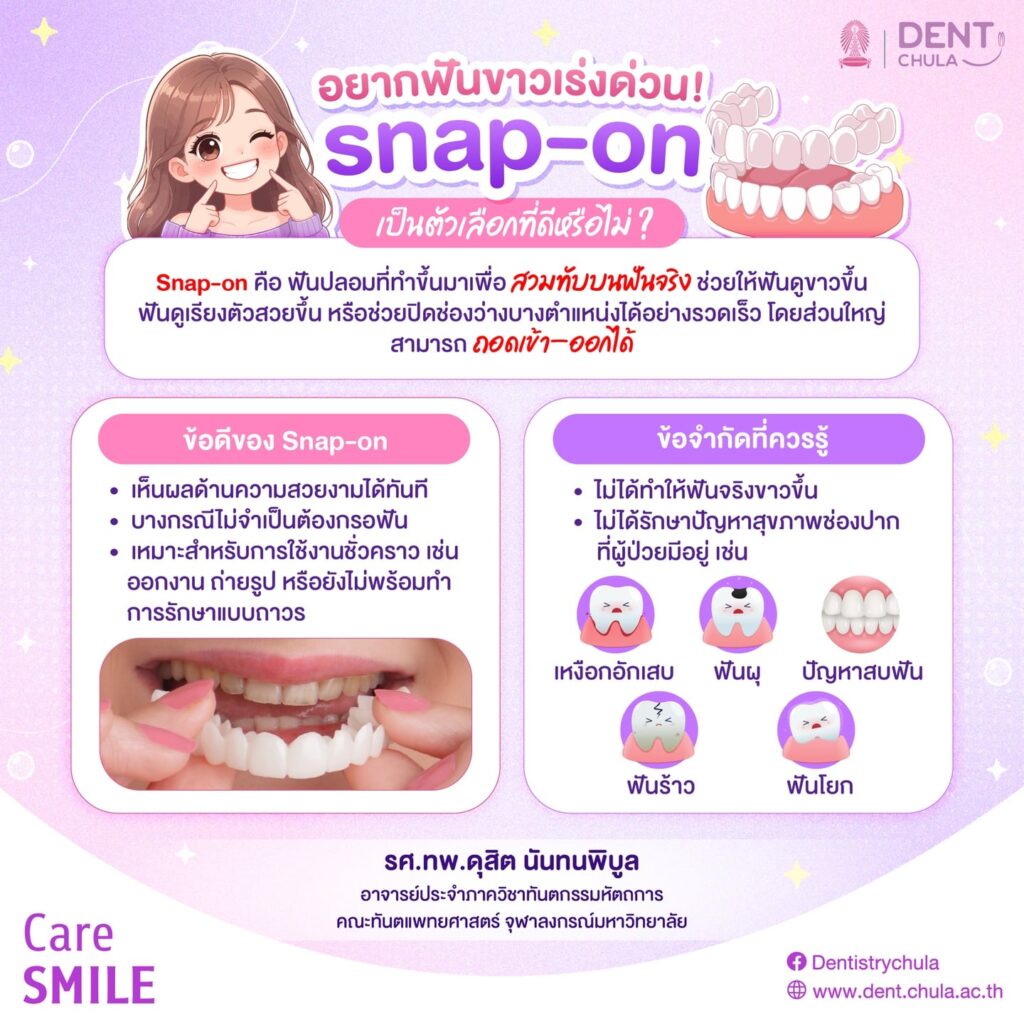 snap on 1 0 คณะทันตแพทยศาสตร์ จุฬาลงกรณ์มหาวิทยาลัย