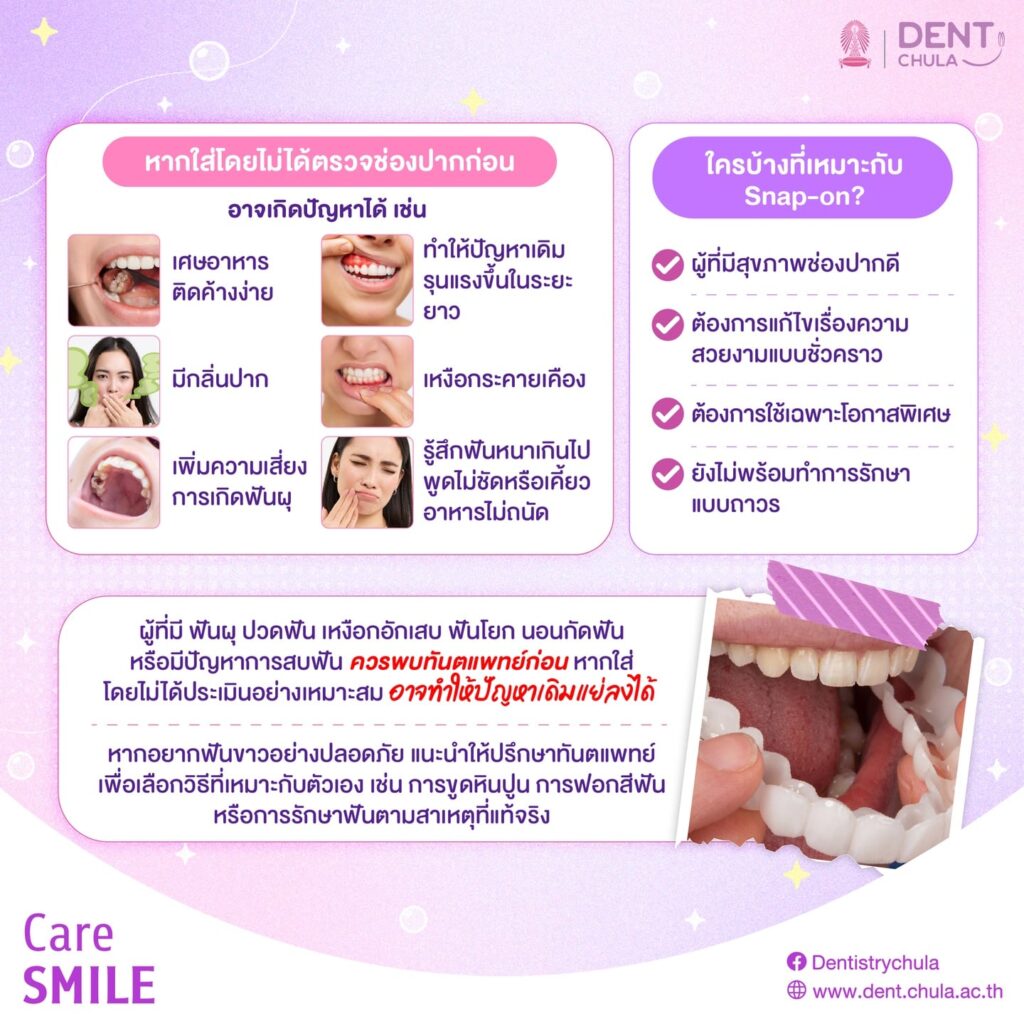 snap on 2 0 คณะทันตแพทยศาสตร์ จุฬาลงกรณ์มหาวิทยาลัย