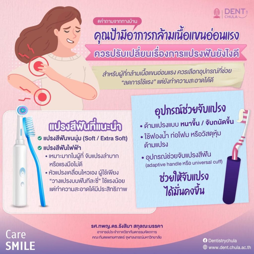 กล้ามเนื้อแขนอ่อนแรง 01 คณะทันตแพทยศาสตร์ จุฬาลงกรณ์มหาวิทยาลัย