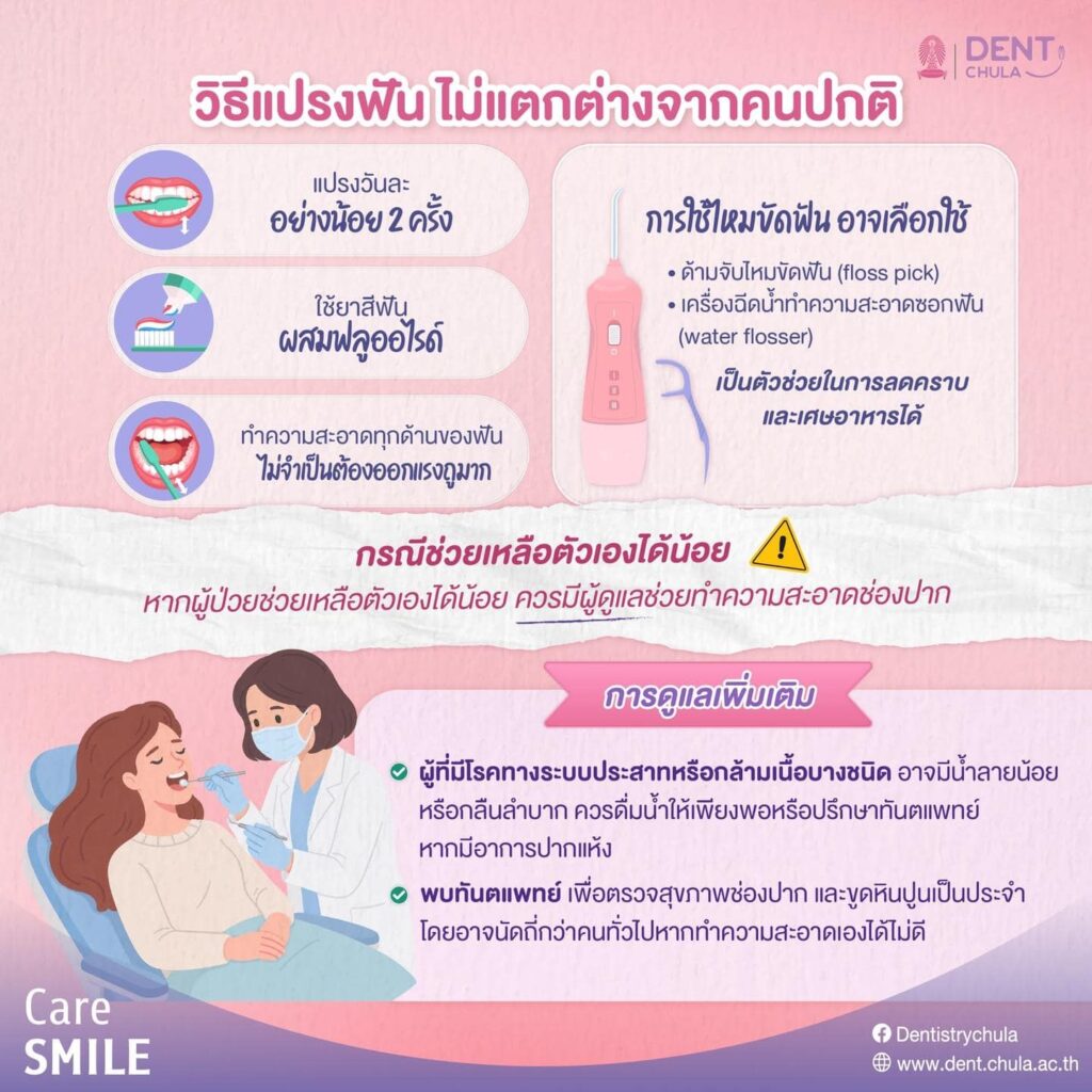 กล้ามเนื้อแขนอ่อนแรง 02 คณะทันตแพทยศาสตร์ จุฬาลงกรณ์มหาวิทยาลัย