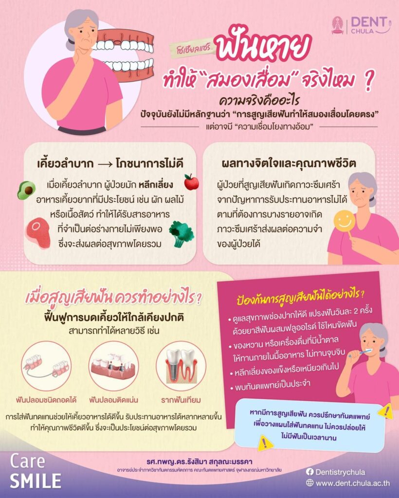 การสูญเสียฟันส่งผลต่อสมองจริงไหม คณะทันตแพทยศาสตร์ จุฬาลงกรณ์มหาวิทยาลัย
