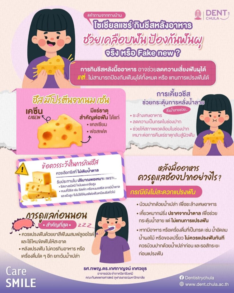 กินชีสเพื่อช่วยเคลือบฟันได้จริงไหม คณะทันตแพทยศาสตร์ จุฬาลงกรณ์มหาวิทยาลัย