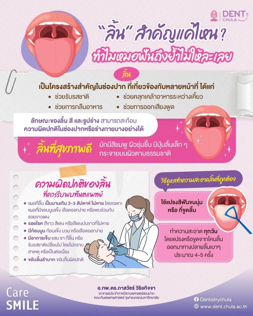 ความผิดปกติของลิ้นที่ควรสังเกต คณะทันตแพทยศาสตร์ จุฬาลงกรณ์มหาวิทยาลัย
