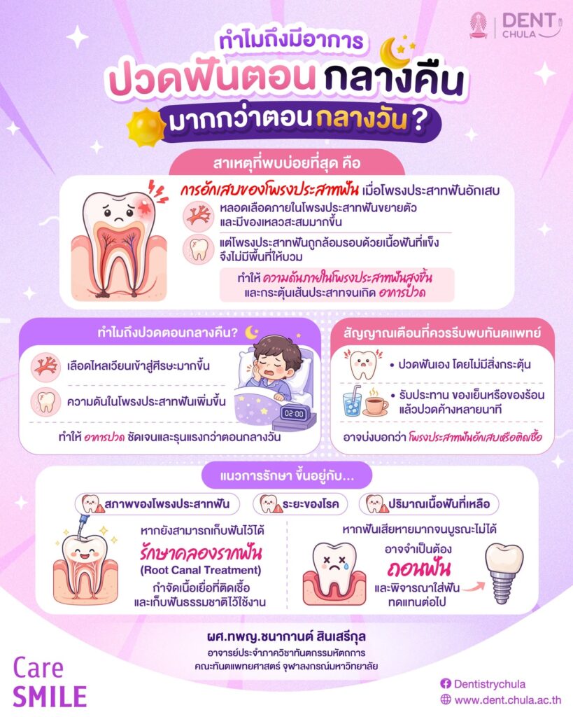 ปวดฟันเฉพาะตอนกลางคืน อันตรายแค่ไหน คณะทันตแพทยศาสตร์ จุฬาลงกรณ์มหาวิทยาลัย