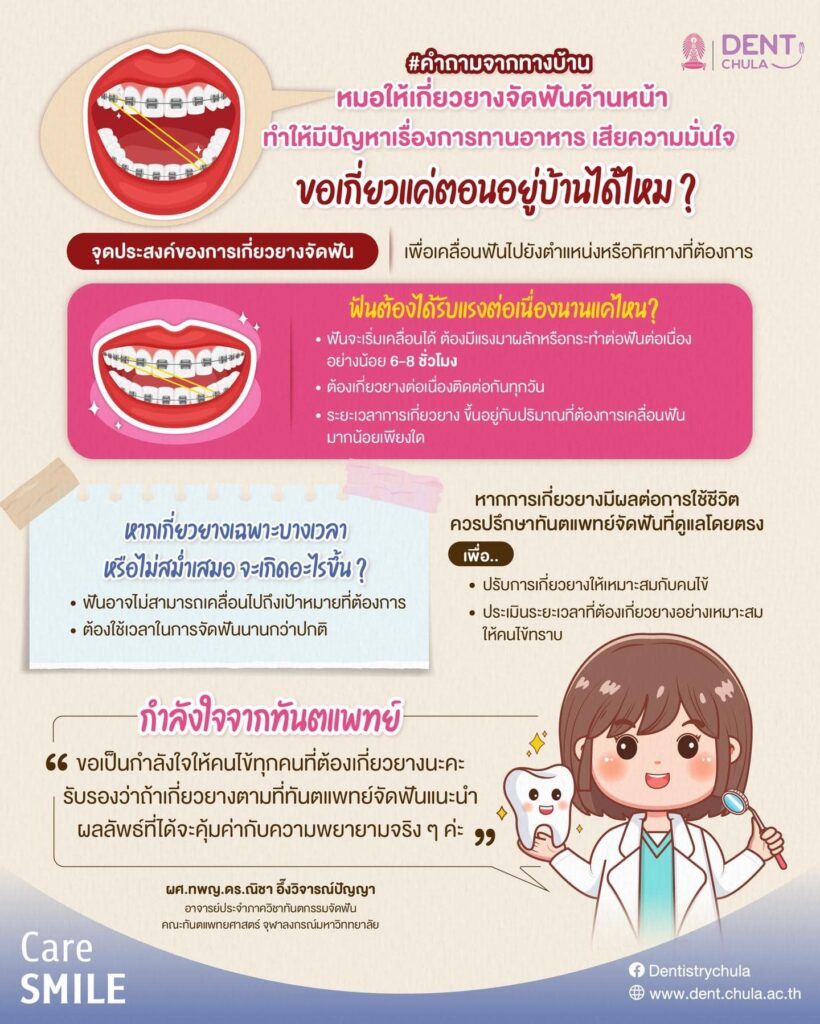 ปัญหาการเกี่ยวยาง คณะทันตแพทยศาสตร์ จุฬาลงกรณ์มหาวิทยาลัย