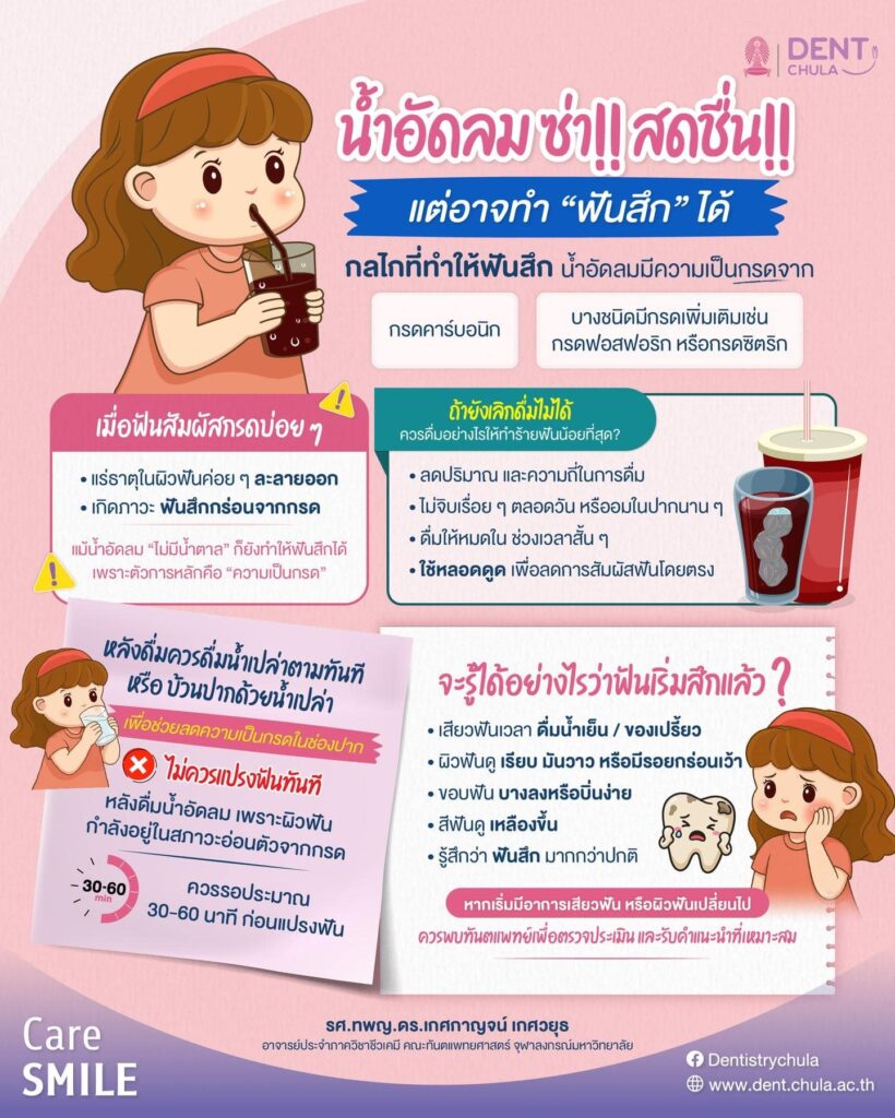 ปัญหาฟันสึกในคนชอบดื่มน้ำอัดลม คณะทันตแพทยศาสตร์ จุฬาลงกรณ์มหาวิทยาลัย