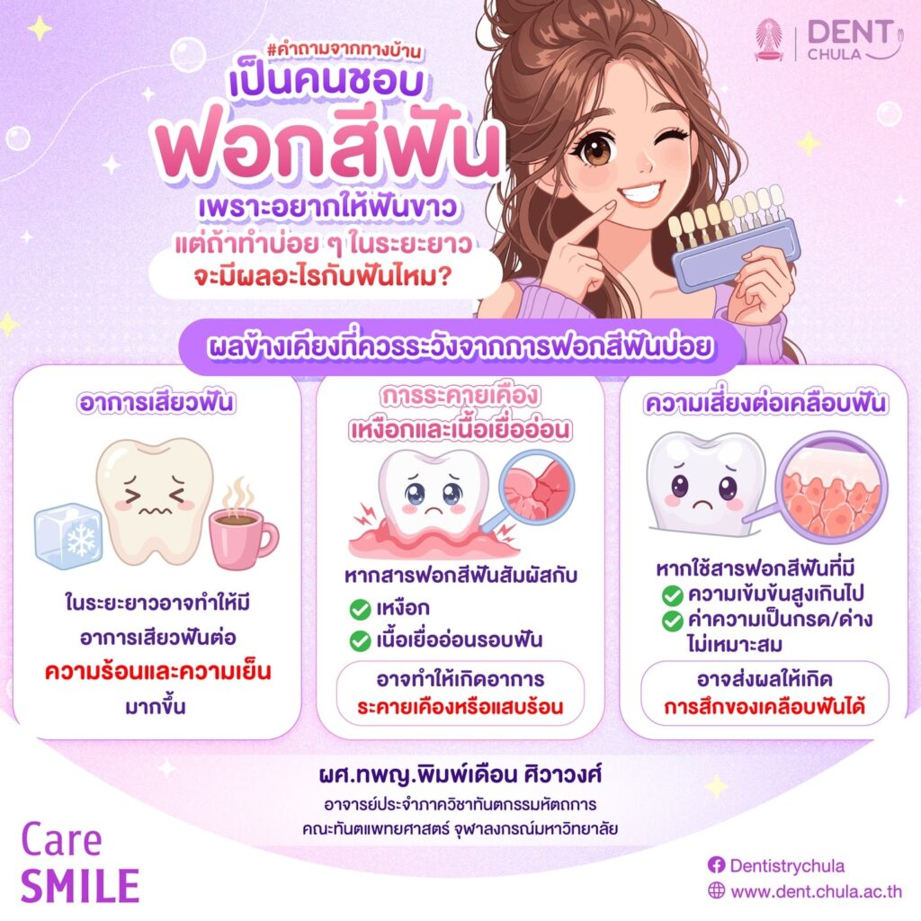 ฟอกฟันขาวบ่อยๆ 1 0 1 คณะทันตแพทยศาสตร์ จุฬาลงกรณ์มหาวิทยาลัย