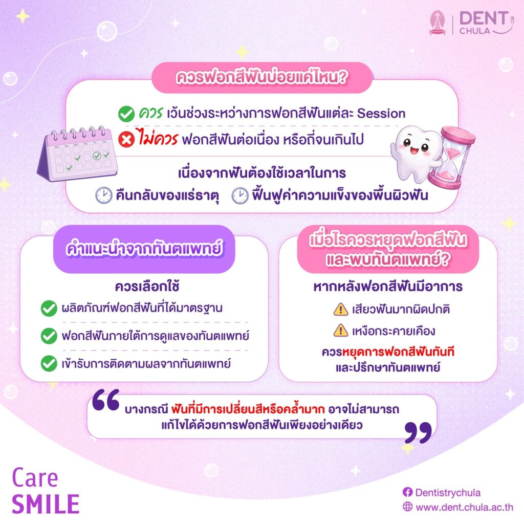ฟอกฟันขาวบ่อยๆ 2 0 คณะทันตแพทยศาสตร์ จุฬาลงกรณ์มหาวิทยาลัย