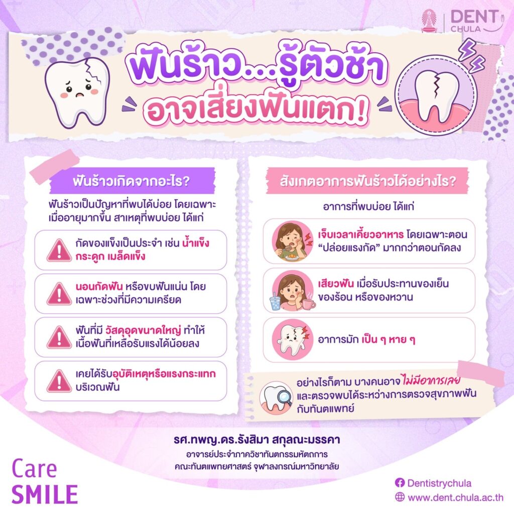 ฟันร้าวสังเกตอย่างไร 1 0 คณะทันตแพทยศาสตร์ จุฬาลงกรณ์มหาวิทยาลัย