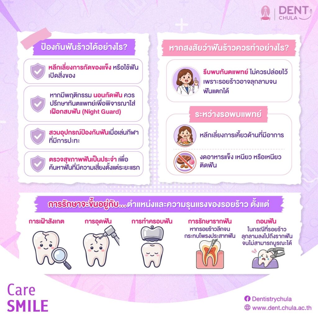 ฟันร้าวสังเกตอย่างไร 2 0 คณะทันตแพทยศาสตร์ จุฬาลงกรณ์มหาวิทยาลัย