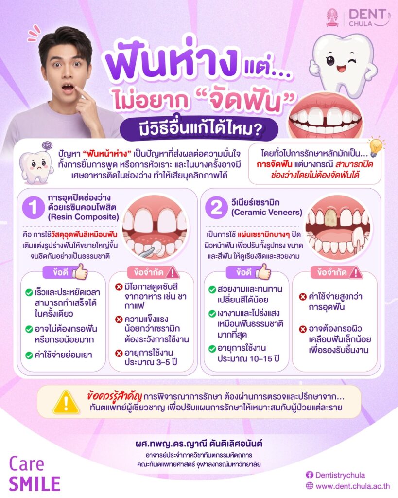 ฟันห่าง แต่ไม่อยากจัดฟัน แก้ยังไง คณะทันตแพทยศาสตร์ จุฬาลงกรณ์มหาวิทยาลัย