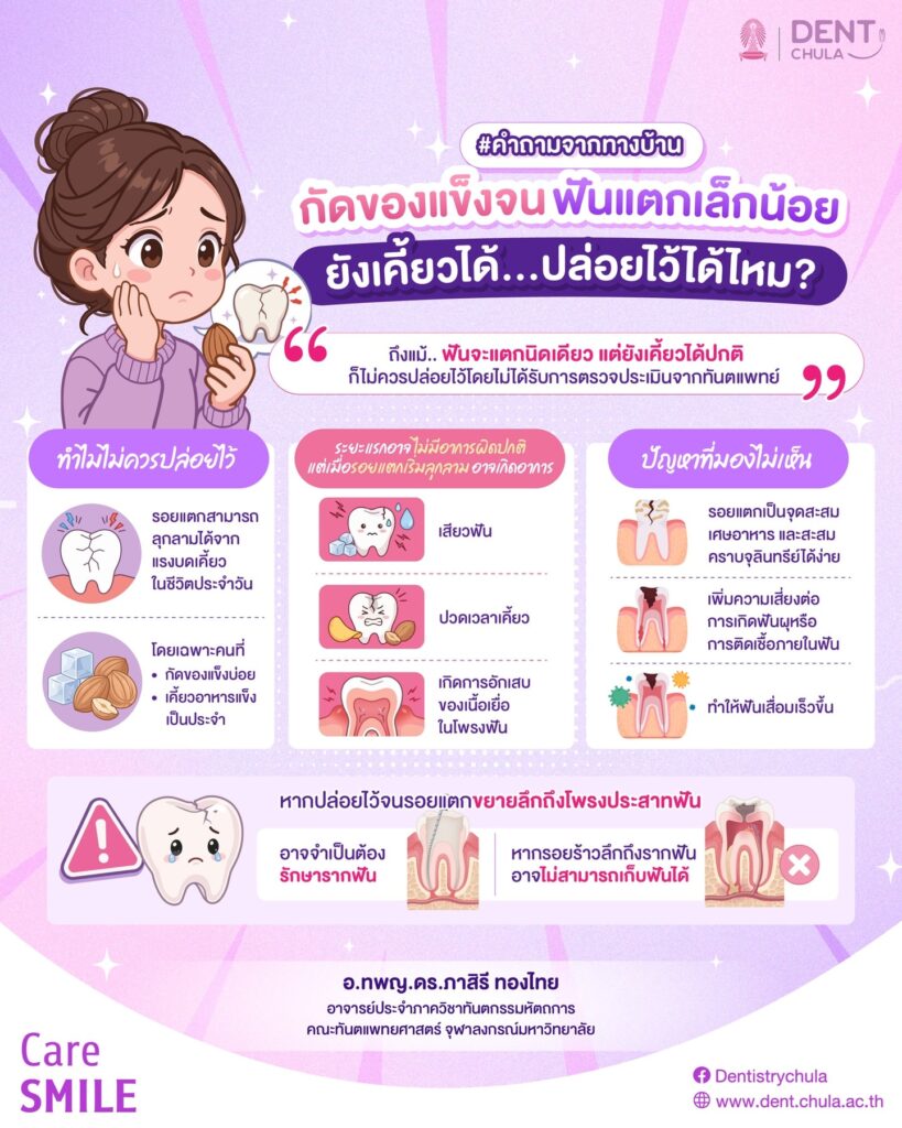 ฟันแตกเล็กน้อย ปล่อยไว้ได้หรือไม่ คณะทันตแพทยศาสตร์ จุฬาลงกรณ์มหาวิทยาลัย