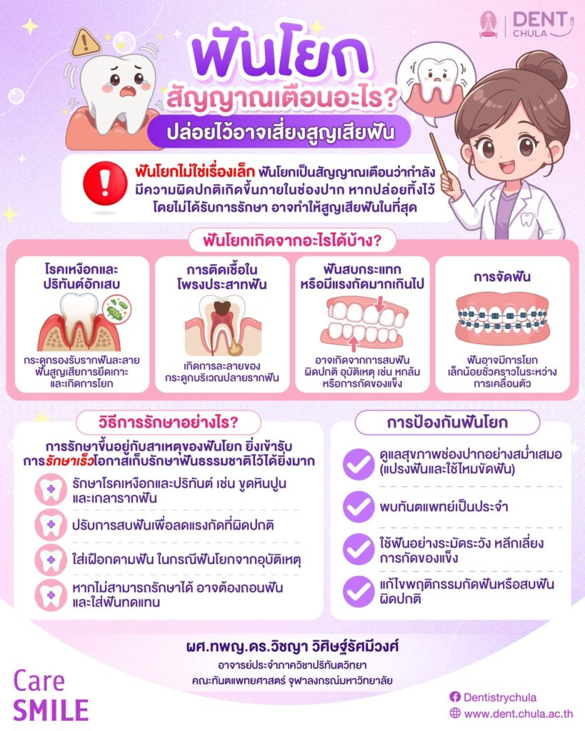 ฟันโยกเป็นสัญญาณของโรคอะไร คณะทันตแพทยศาสตร์ จุฬาลงกรณ์มหาวิทยาลัย